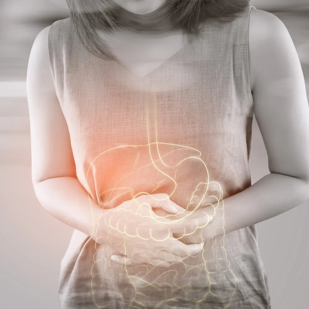 Colitis