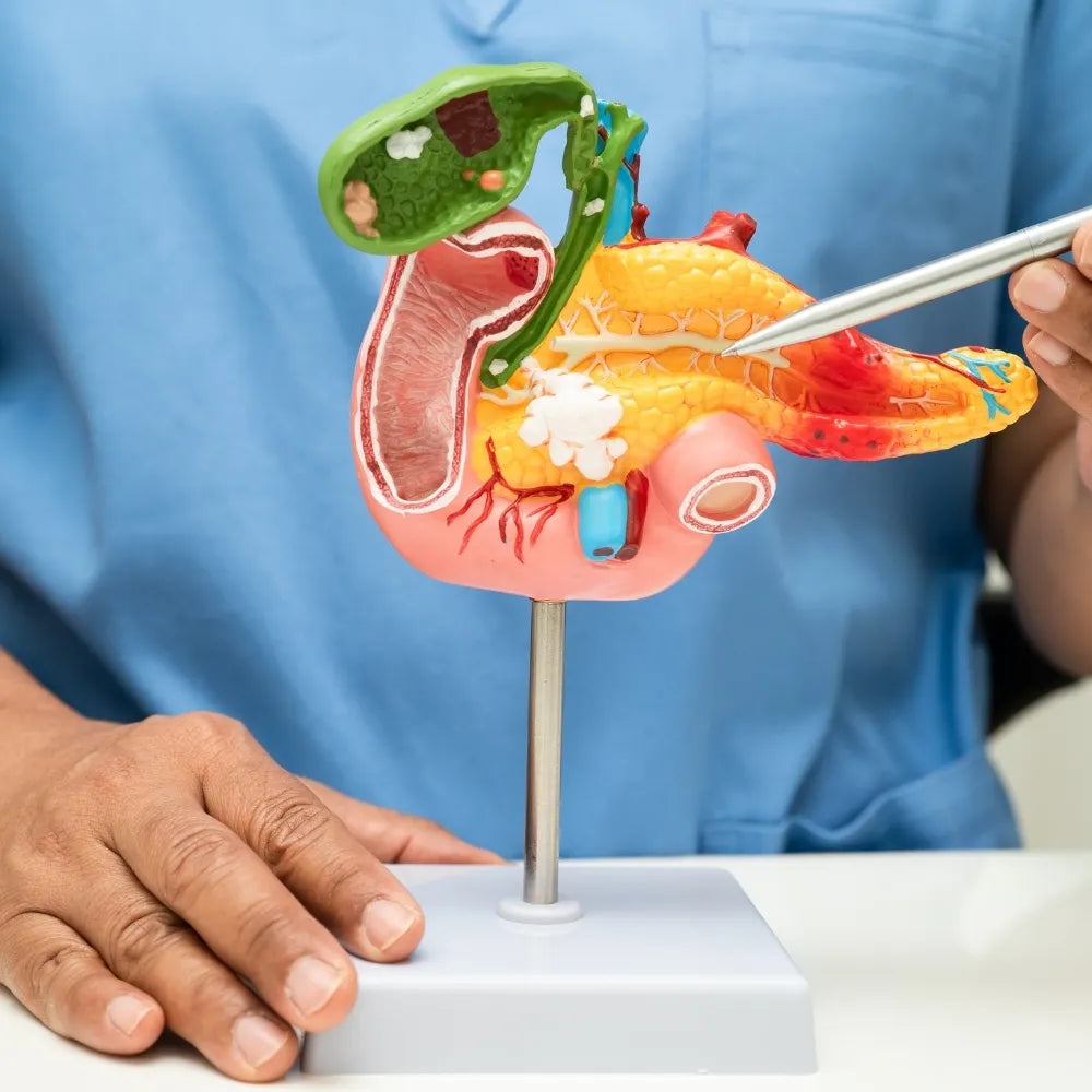 Pancreatitis