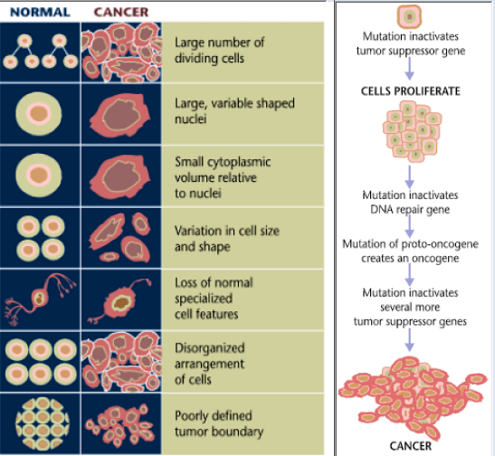 benign tumor vs malignant