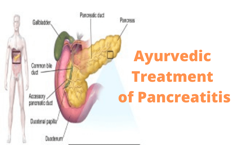 Ayurvedic treatment of pancreatitis