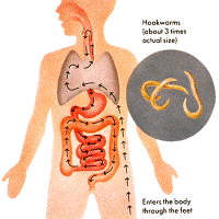 Worm Infestation – Ayurvedic Treatment